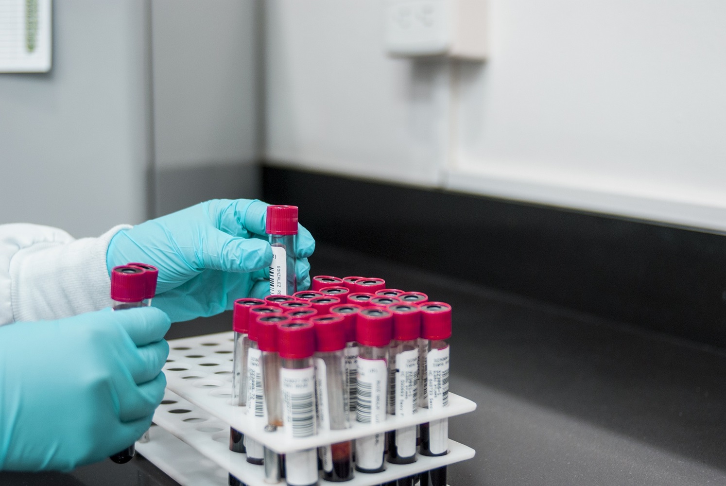 AI breakthrough: Blood test could predict Parkinson's years before symptoms
